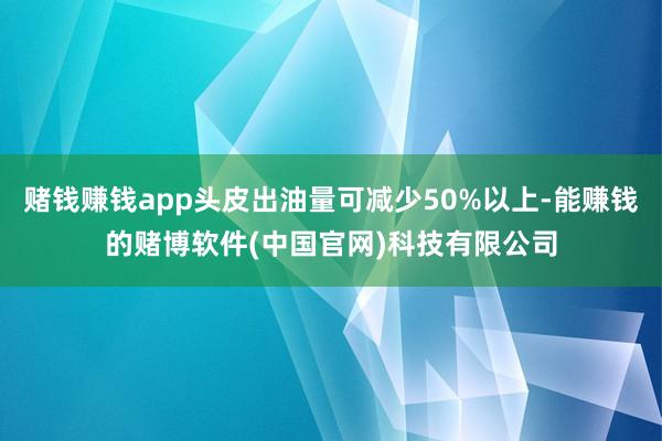 赌钱赚钱app头皮出油量可减少50%以上-能赚钱的赌博软件(中国官网)科技有限公司